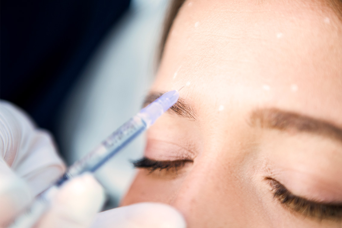 Faltenbehandlung in Frankfurt Hautarzt Frankfurt, Dermatologie Grawert, Dr. Leonie von Grawert, Hautarztpraxis Frankfurt, Faltenbehandlung, Falten reduzieren, Faltenreduktion, Reduzierung von Falten